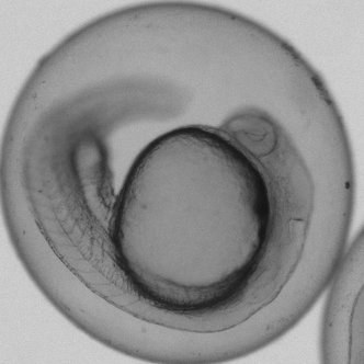 Real zebrafish embryo, brightfield