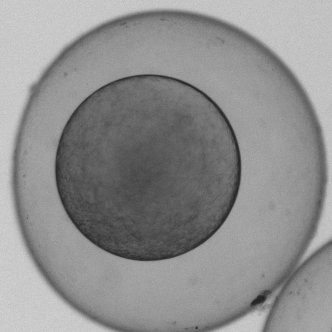 Real zebrafish embryo, brightfield