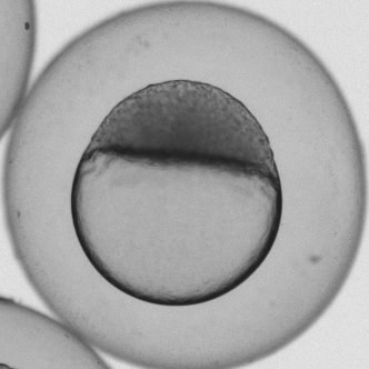 Real zebrafish embryo, brightfield