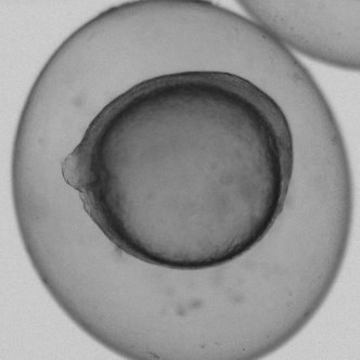 Real zebrafish embryo, brightfield