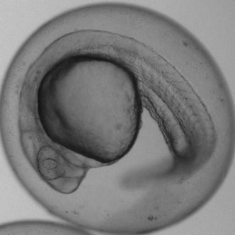 Real zebrafish embryo, brightfield